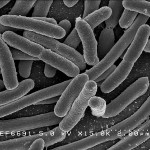 Crowdsourcing Helping to Stop a Killer Bacterium in its Tracks