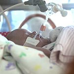 Artificial Placenta Could Save Premature Infants