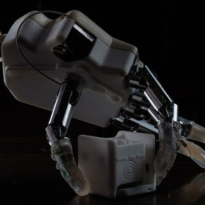 Bionic Hand Increases Sensory Imput