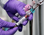 Blood Test for Cancer Looks for DNA Battle Damage