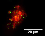 Gold Nanorods Inhibit Cancer Growth