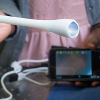 Handheld Colposcope Detects Cervical Cancer