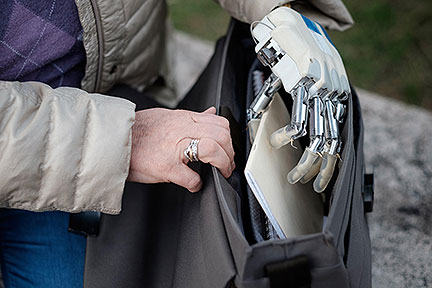 Bionic Hand Increases Sensory Imput