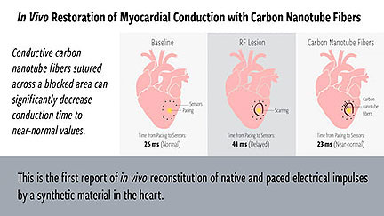 Conductive Fibers Heal Damaged Hearts
