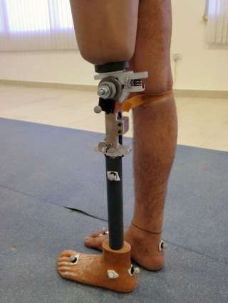Low-Cost Knee Prosthetic