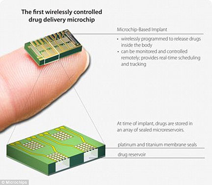 Remote-Controlled Contraceptive Lasts Sixteen Years