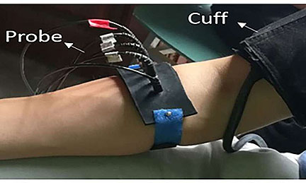 Wearable Device Detects Strokes with Light