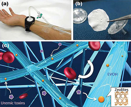 Wearable Nanomesh Could Replace Dialysis Machines