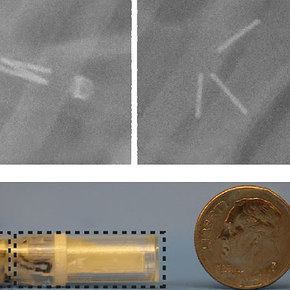 Microneedle Capsule Delivers Insulin Orally