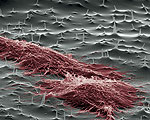 Nano Needles Test Individual Cells