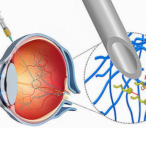 Nanopropellers Deliver Drugs to the Eye