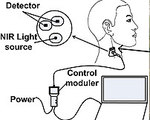 Optical Probe Monitors Shock Non-Invasively