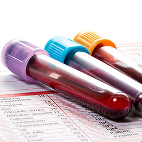Universal Cancer Blood Test