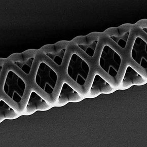 World's Smallest Stent Could Save Infant Lives