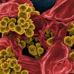 Scientists Tap the Crowd for New Antibiotics