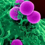 Crowdsourcing Antibiotic Resistance Drugs