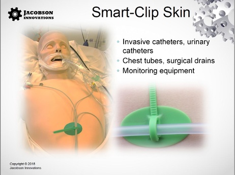 Smart-Clip Skin Pic.jpg