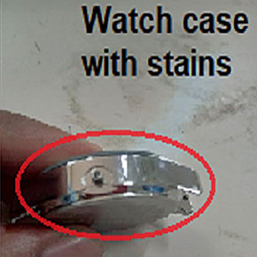 Elimination of Stains from Watch Case Assemblies