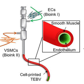 3D-Printed Artifical Blood Vessel