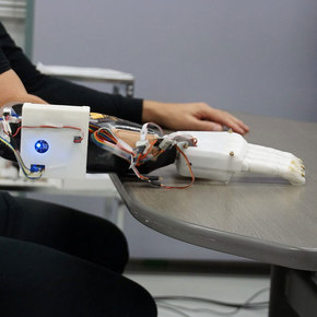 3D-Printed Prostheic is a Quick Learner