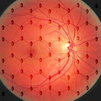 Artificial Retina Made from Graphene