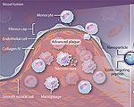 Biodegradable Nanodrones Target Arterial Plaque