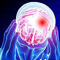 Blood Test Detects Concussion
