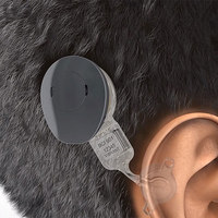 Bonebridge Wireless Hearing Aid System