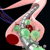 Catching Tumor Cells with Magnetized Wires