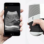 Clarius Wireless Ultrasound Scanners Step Outside