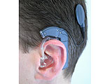 Cochlear Implants with no External Components