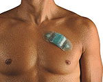 Compact ZIO Heart-Monitoring Patch Outperforms Traditional Options