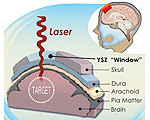 Cranial Implant Provides a Window to the Brain