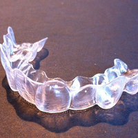 Dental Retainer Coating Repels Bacteria