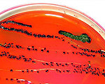Early Warning E. Coli Detection System may Send Text Alerts