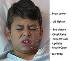 Facial Recognition System Measures Pain Levels