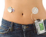 First Artificial Pancreas Device System with Threshold Suspend