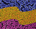 Gold Nano-Sponge Detects Pathogens