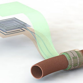 Implantable Sensor Monitors Blood Flow