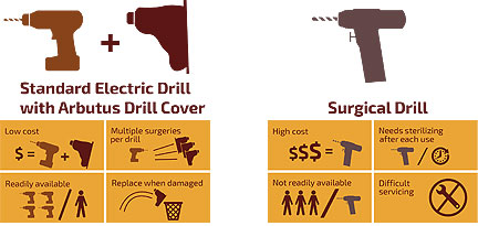 Arbutus Drill Cover Turns a Power Drill into a Surgical Tool