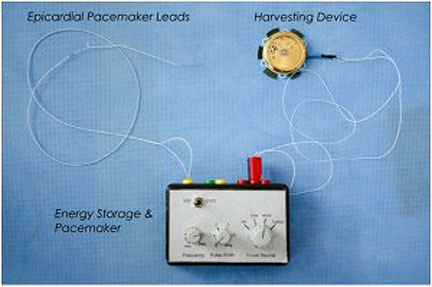 Battery-Free Pacemaker Based on Wristwatch Technology