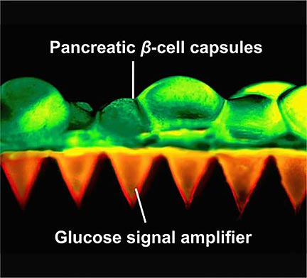 Beta Cells Make Smart Insulin Patch Smarter