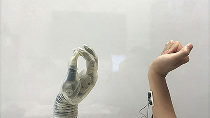 Computer Model Aids in Prosthetic Control