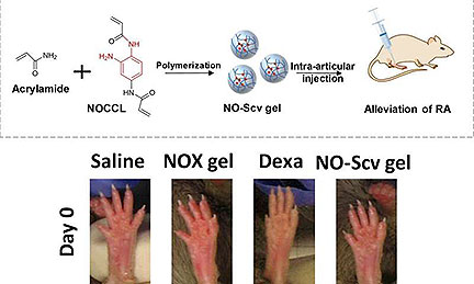 Hydrogel Scavenges Nitric Oxide to Treat Arthritis
