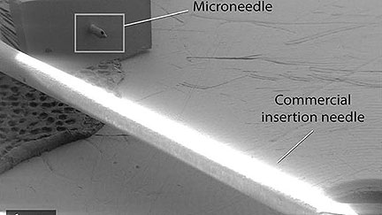 Microneedle Skin Patch Offers Pain-Free Glucose Monitoring