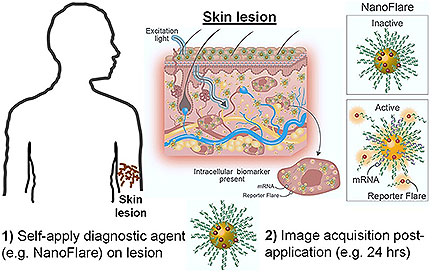 NanoFlare Lotion Detects Diseases