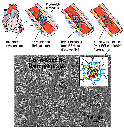 Nanosphere Drug-Delivery System Limits Cardiac Damage