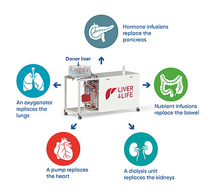 Perfusion Machine Restores and Stores Livers