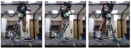 Prosthetic Knee Aided by Machine Learning
