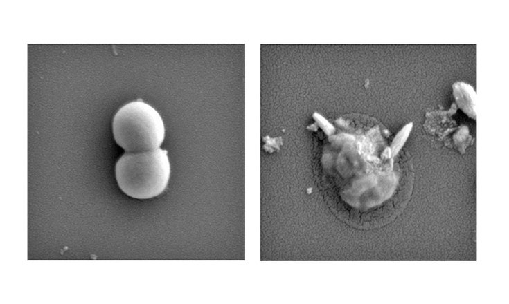 Shape-Shifting Nanoparticles Prevent Superbugs